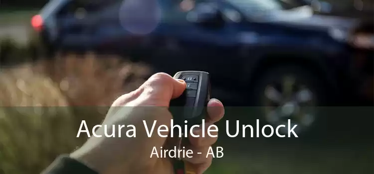 Acura Vehicle Unlock Airdrie - AB