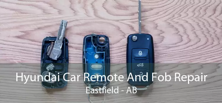Hyundai Car Remote And Fob Repair Eastfield - AB