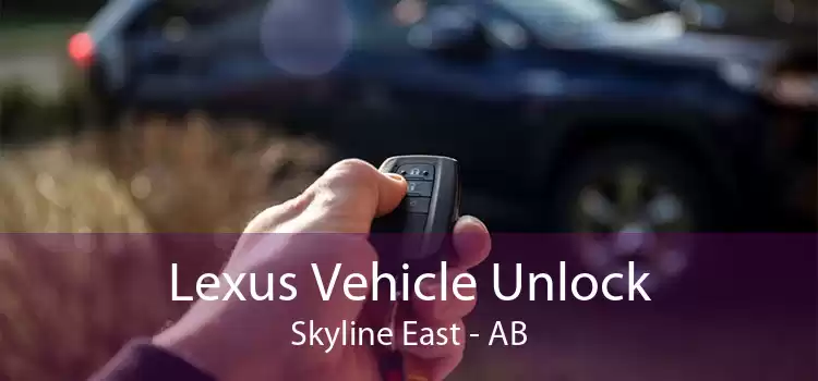 Lexus Vehicle Unlock Skyline East - AB